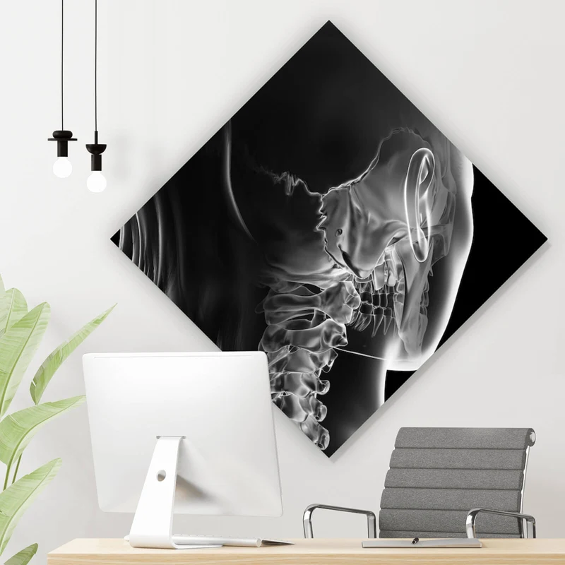 Aluminiumbild gebürstet Anatomische Röntgenkunst Raute