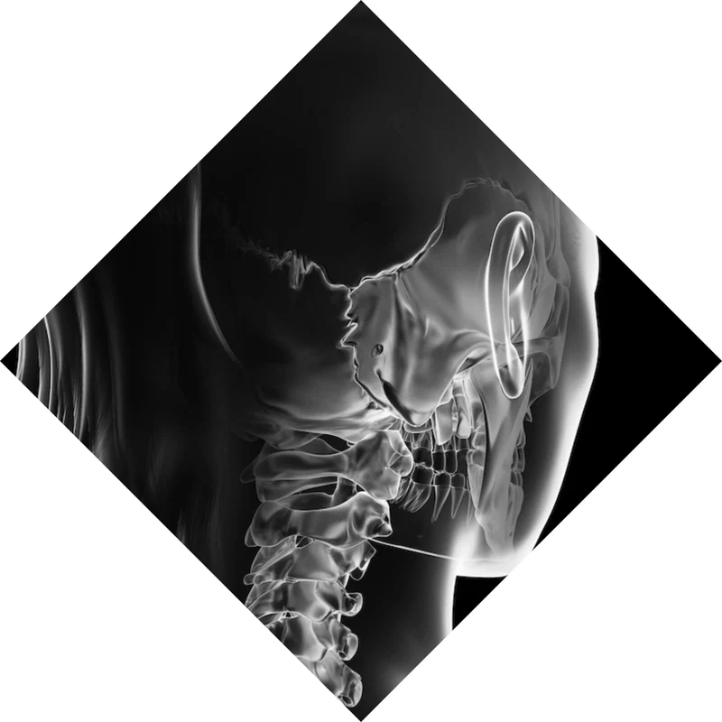 Aluminiumbild gebürstet Anatomische Röntgenkunst Raute