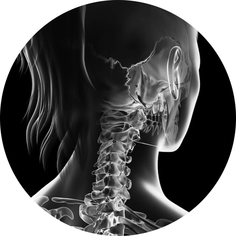Aluminiumbild gebürstet Anatomische Röntgenkunst Kreis