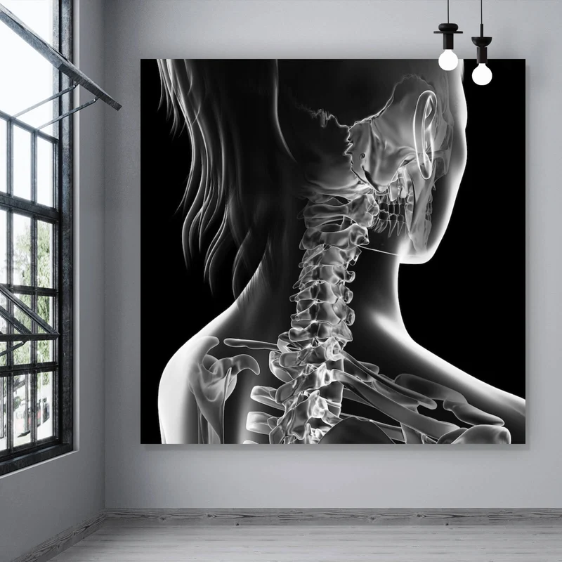 Aluminiumbild Anatomische Röntgenkunst Quadrat