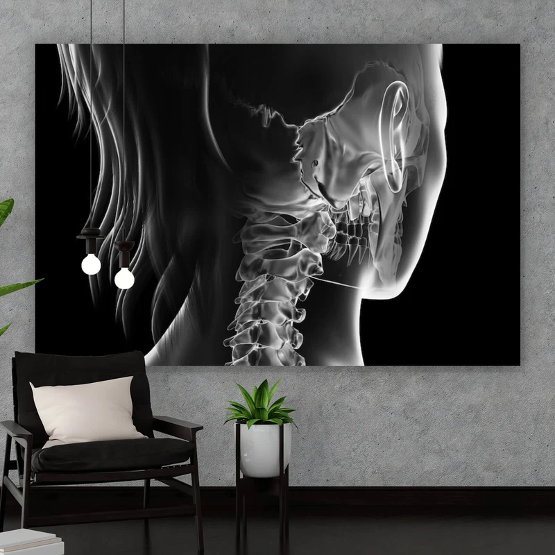 Aluminiumbild Anatomische Röntgenkunst Querformat